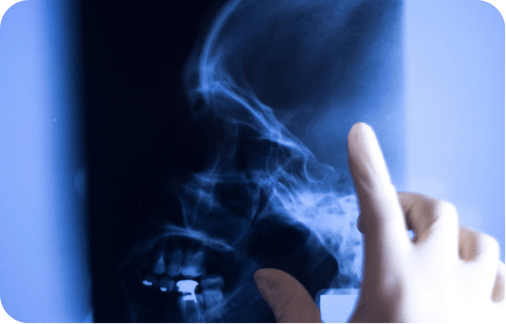 Azataca w360 - facial trauma (3) (1)