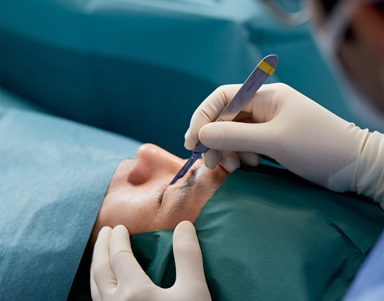 How Facelift Techniques Differ